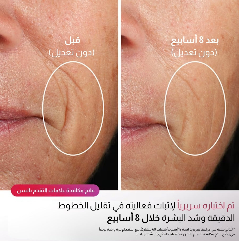 قناع الوجه Shark™ CryoGlow™ بتقنية LED الحمراء والزرقاء وتحت الحمراء مع تبريد تحت العين وحامل شحن (بلو فروست)