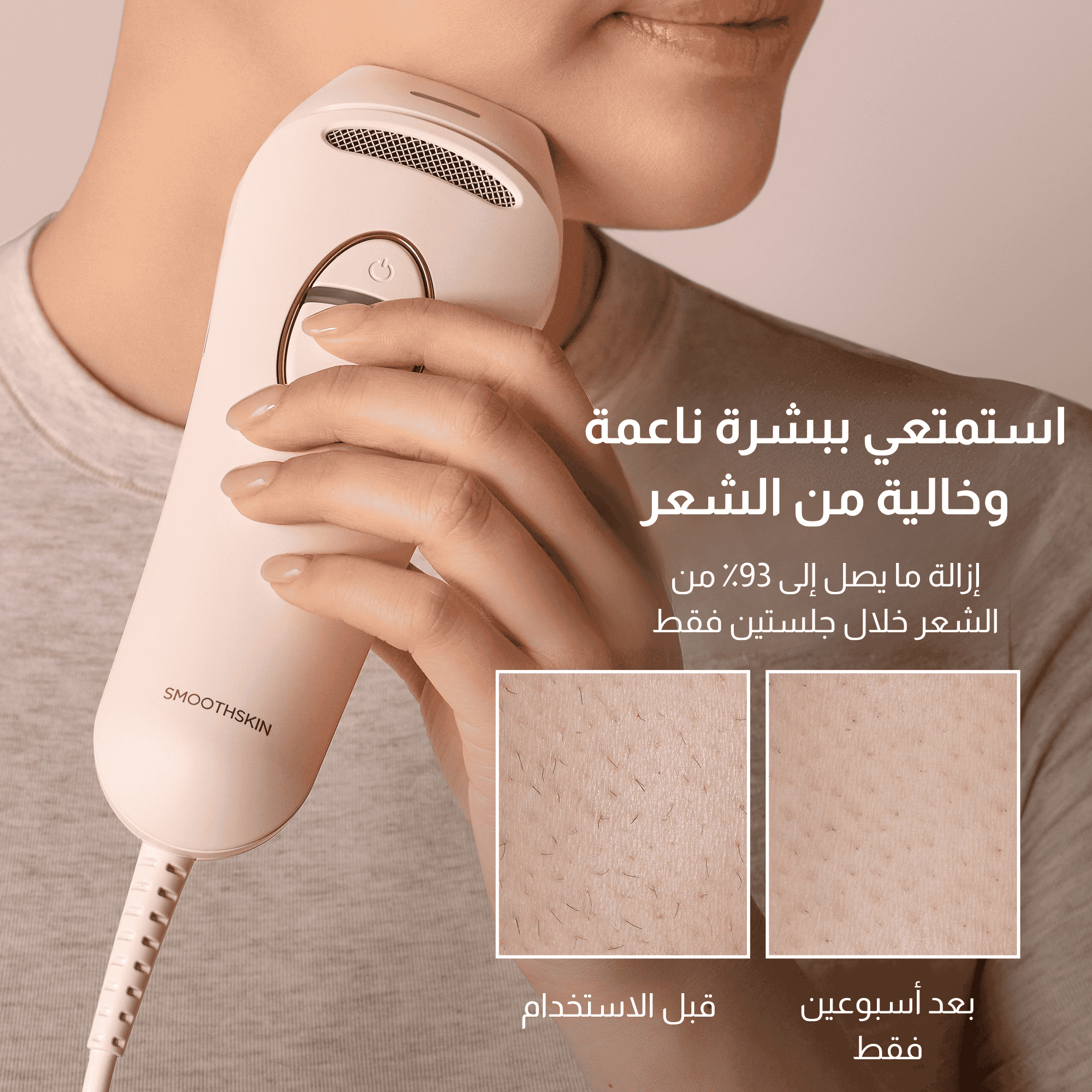 سموث سكين بيور سويتش IPL