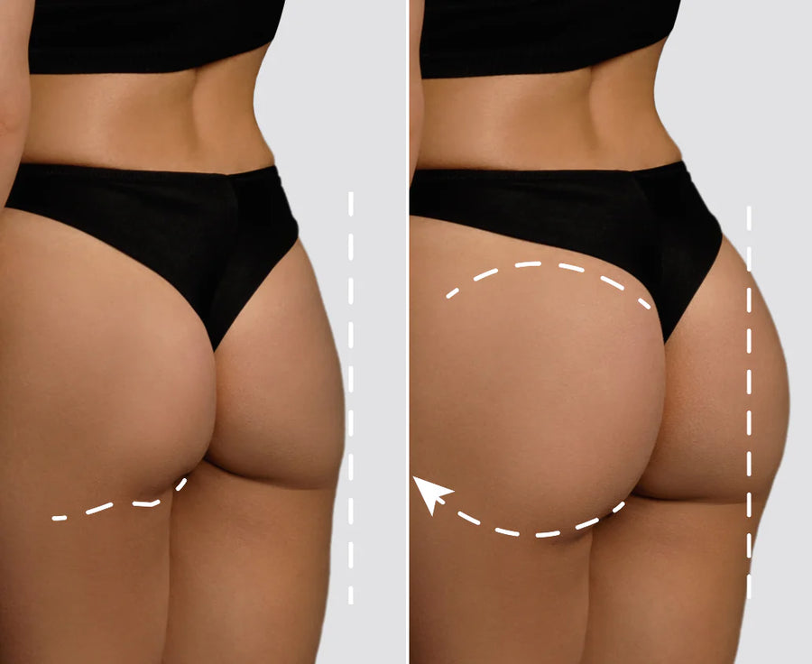 <p>تأثير فعّال لمقاومة الترهّل</p>