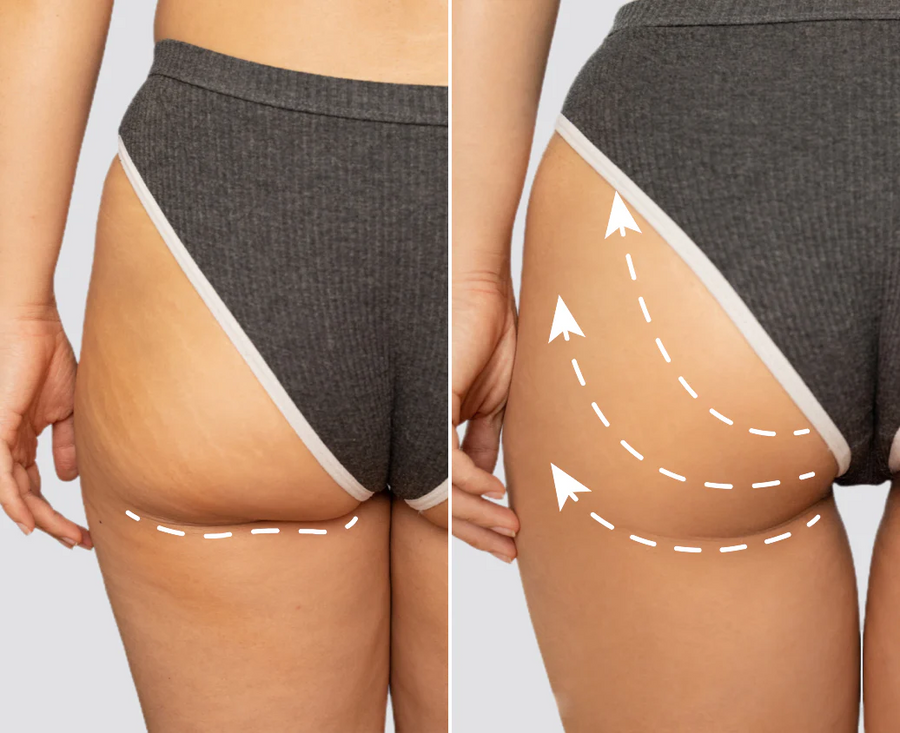 <p>رفع ونحت متقن</p>