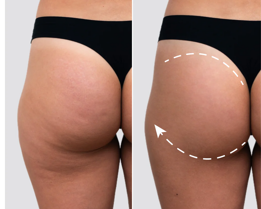 <p>ملمس ناعم وبشرة مشدودة</p>